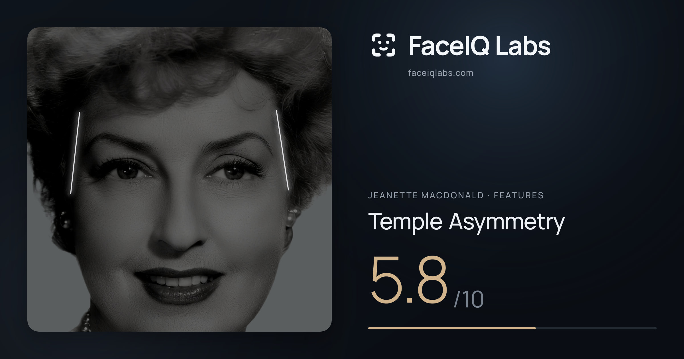 Jeanette MacDonald Temple Asymmetry: 5.8/10, drawn on the photo