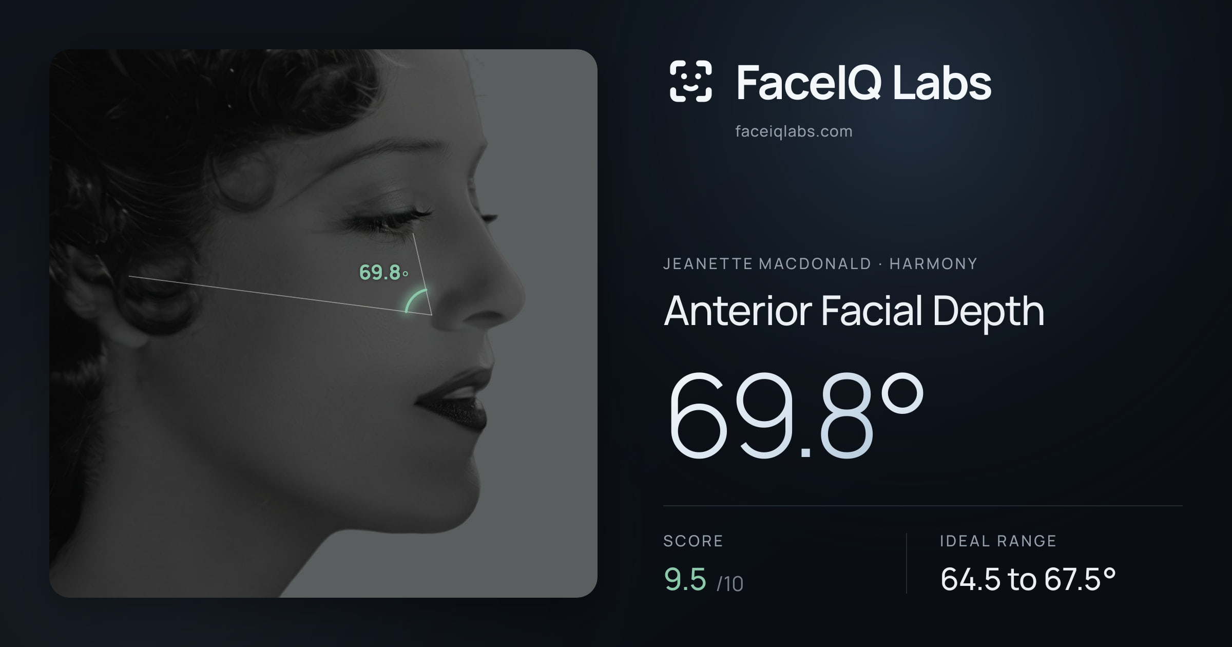 Jeanette MacDonald Anterior Facial Depth: 69.8°, drawn on the photo