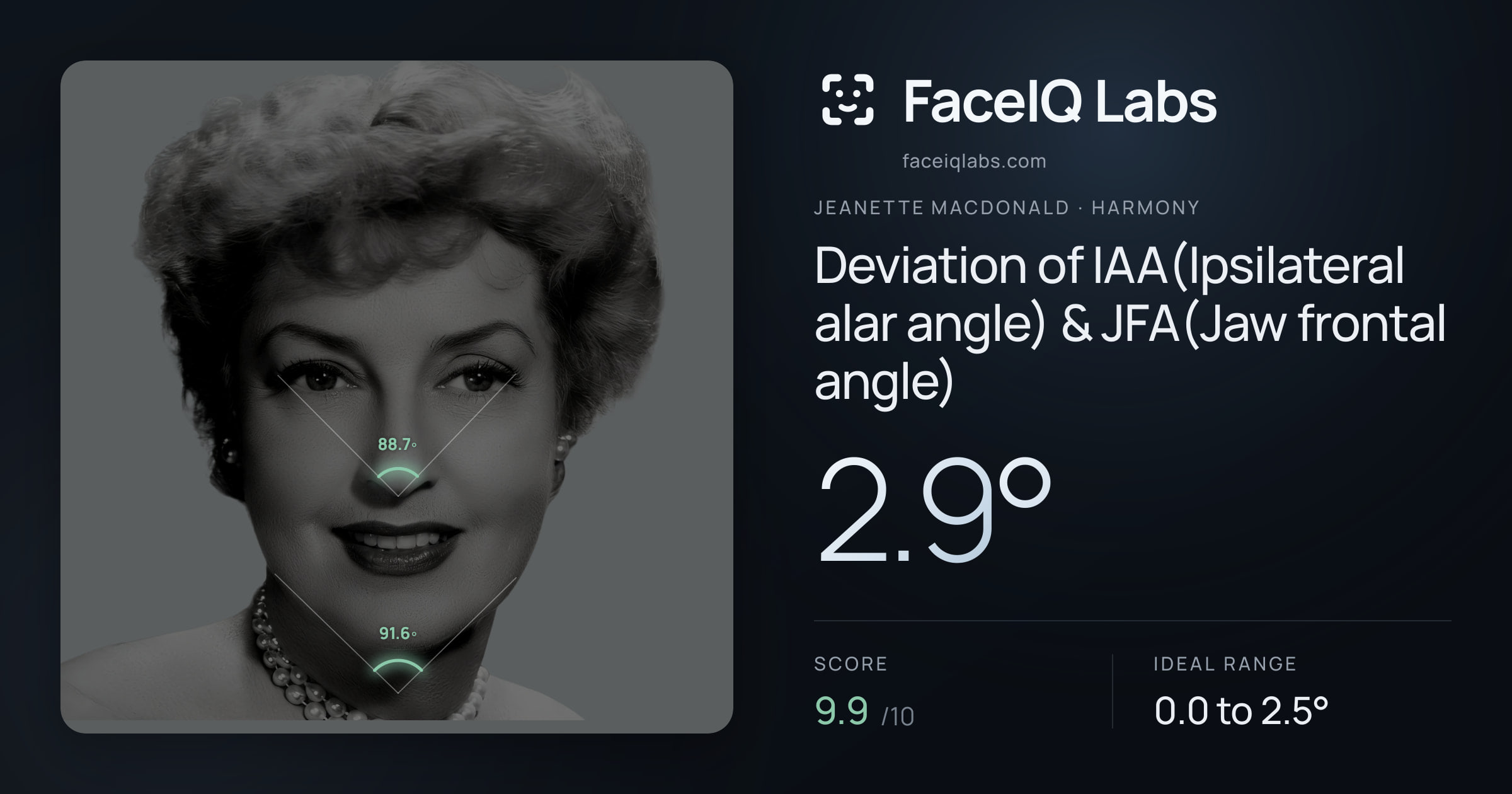 Jeanette MacDonald Deviation of IAA(Ipsilateral alar angle) & JFA(Jaw frontal angle): 2.9°, drawn on the photo