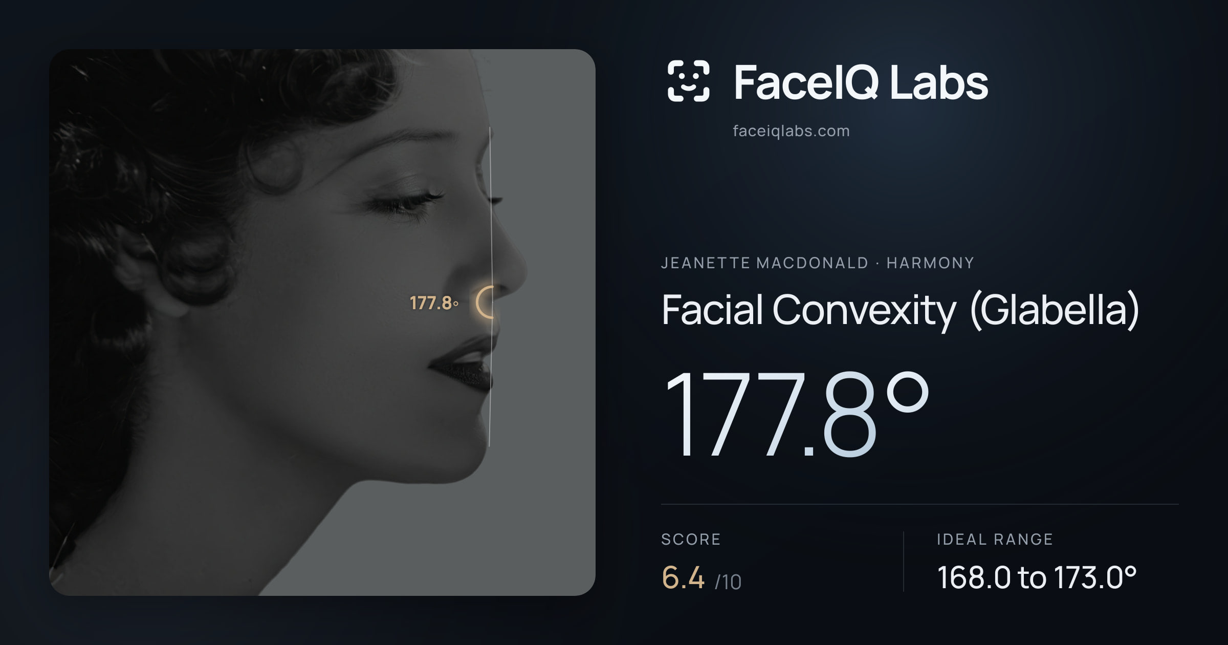 Jeanette MacDonald Facial Convexity (Glabella): 177.8°, drawn on the photo