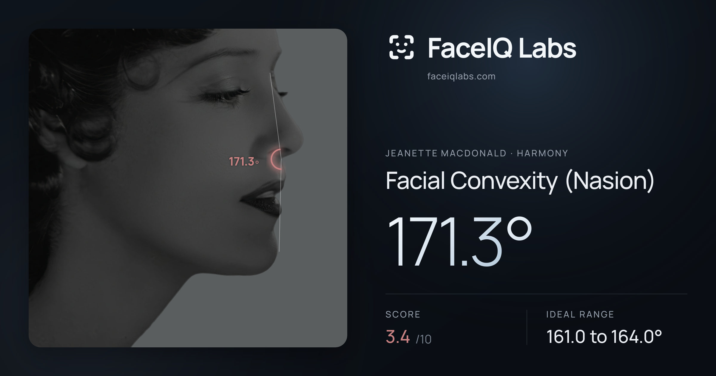 Jeanette MacDonald Facial Convexity (Nasion): 171.3°, drawn on the photo