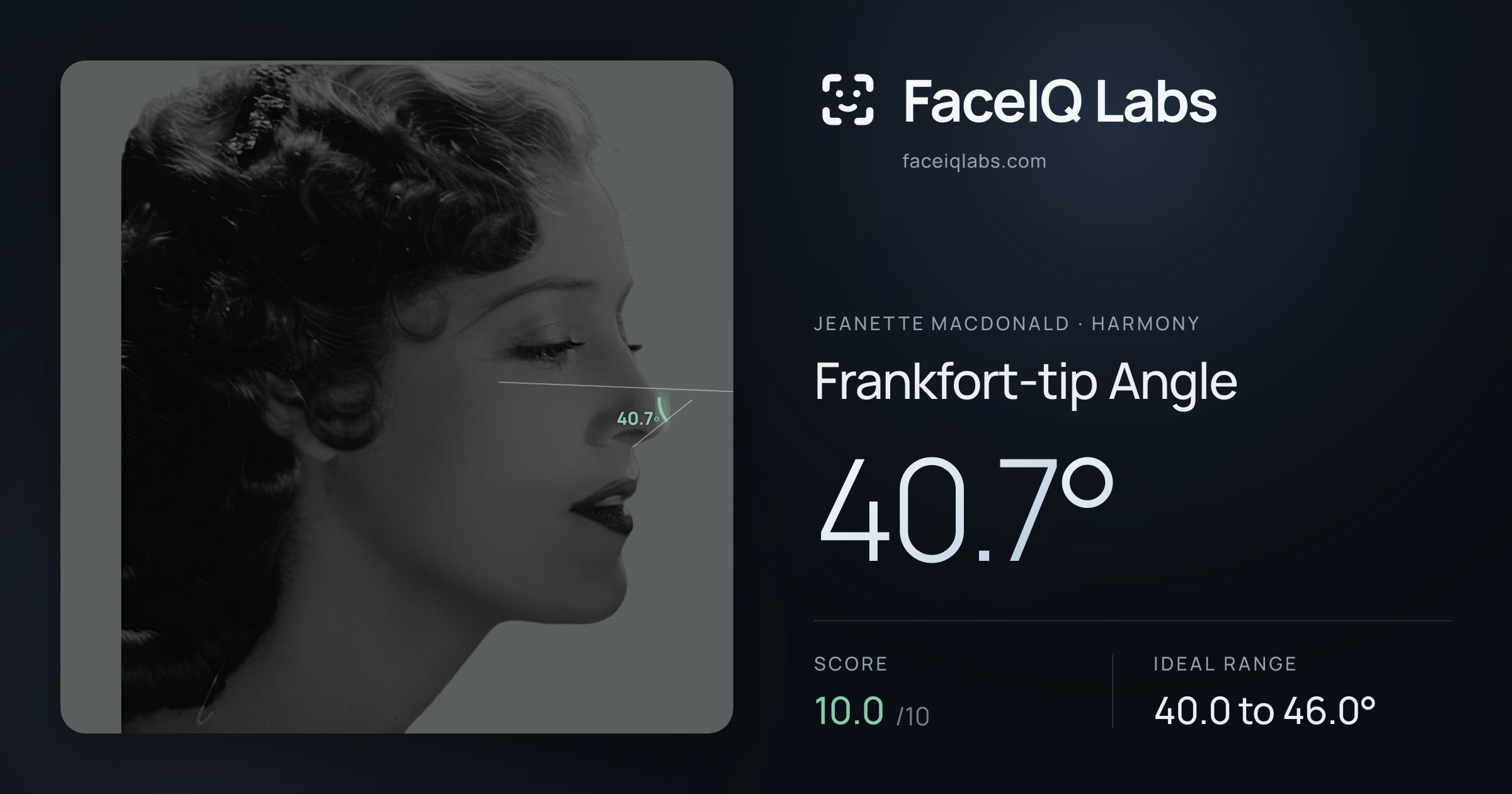 Jeanette MacDonald Frankfort-tip Angle: 40.7°, drawn on the photo