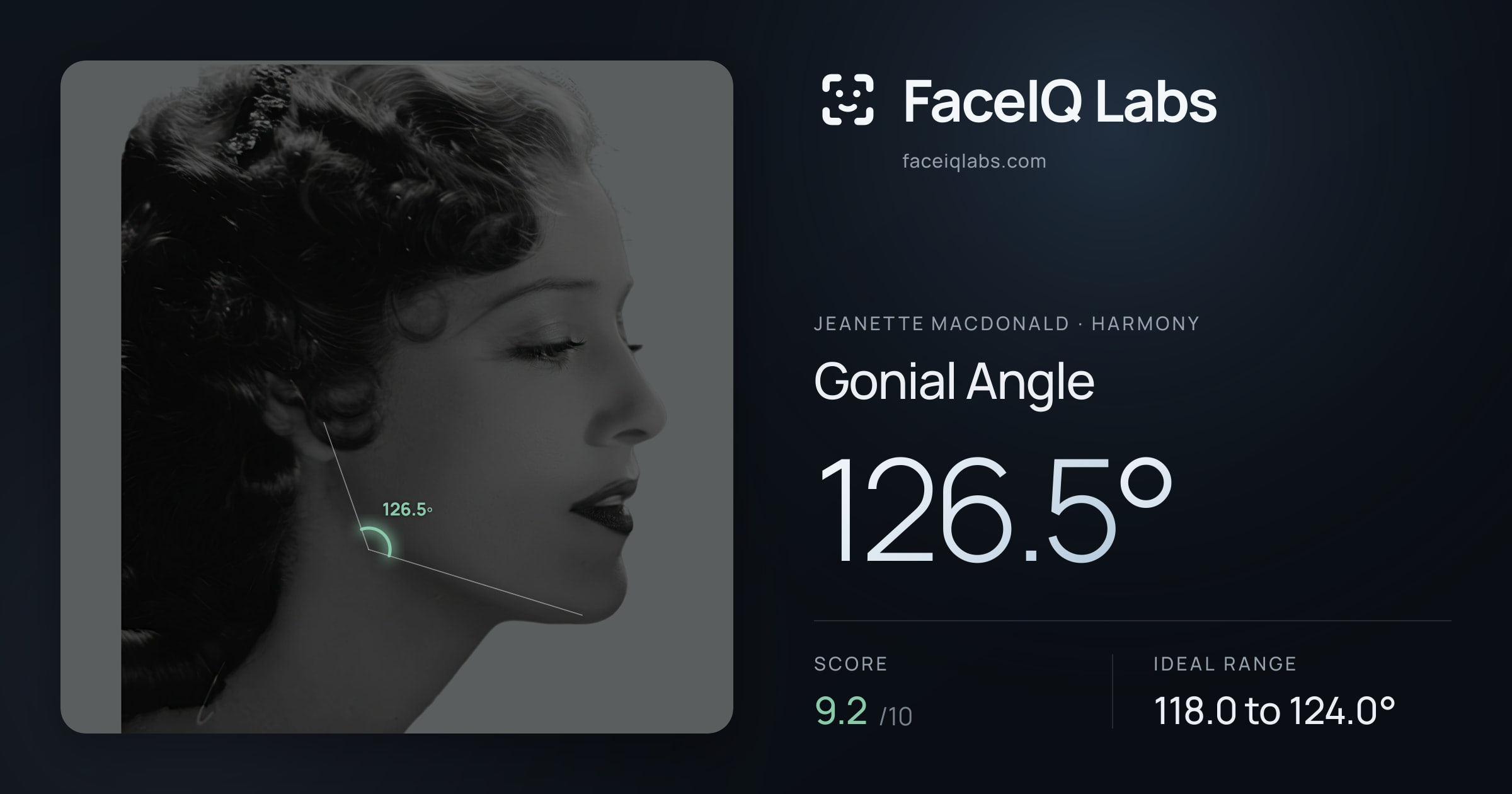 Jeanette MacDonald Gonial Angle: 126.5°, drawn on the photo