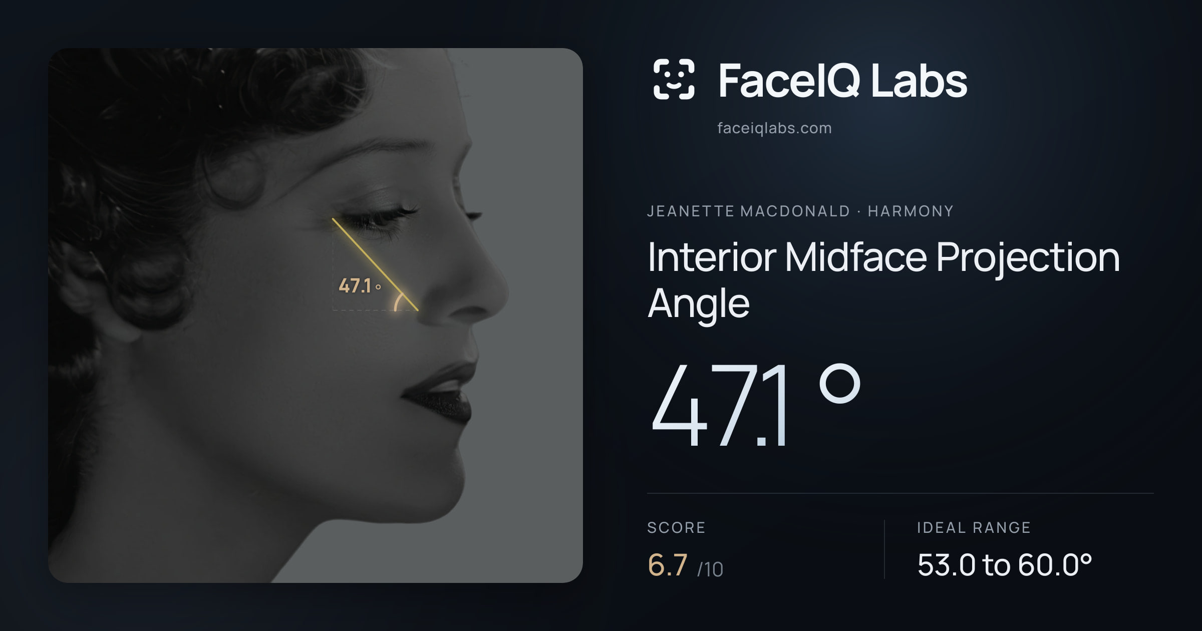Jeanette MacDonald Interior Midface Projection Angle: 47.1°, drawn on the photo