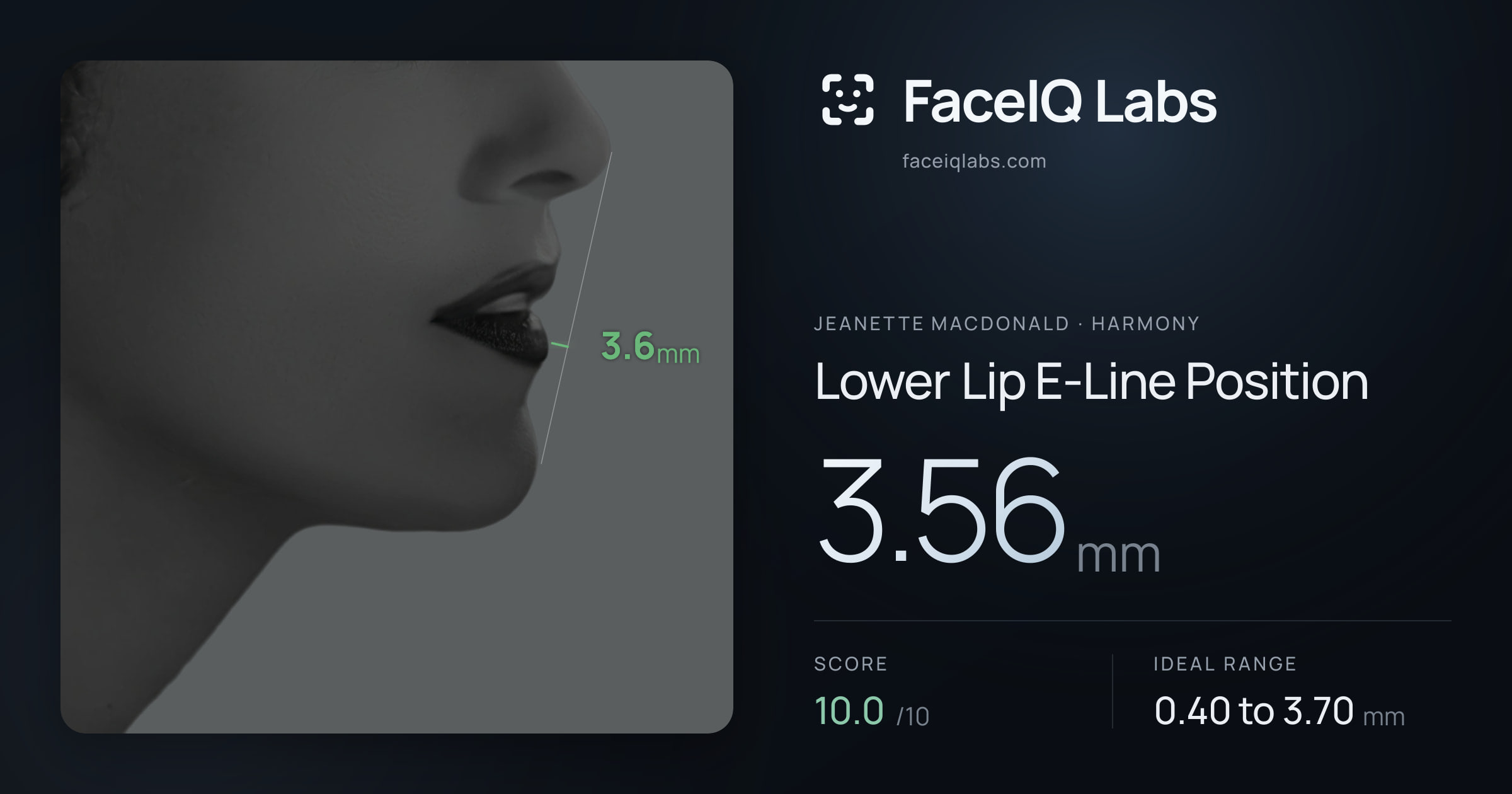 Jeanette MacDonald Lower Lip E-Line Position: 3.56mm, drawn on the photo