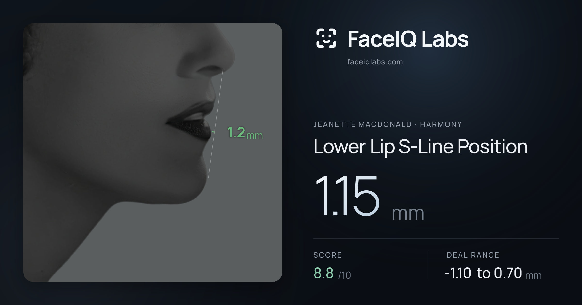 Jeanette MacDonald Lower Lip S-Line Position: 1.15mm, drawn on the photo