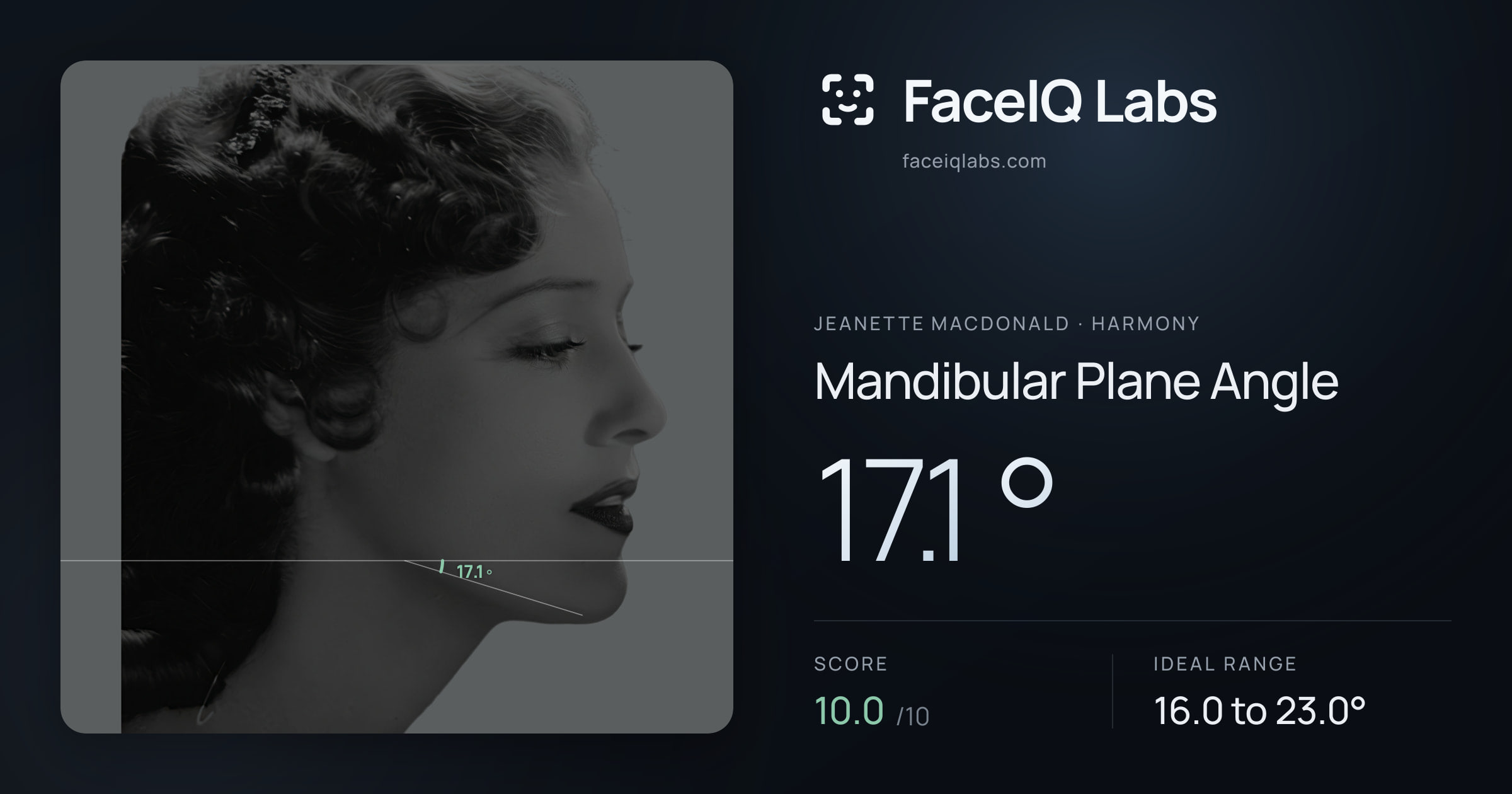 Jeanette MacDonald Mandibular Plane Angle: 17.1°, drawn on the photo