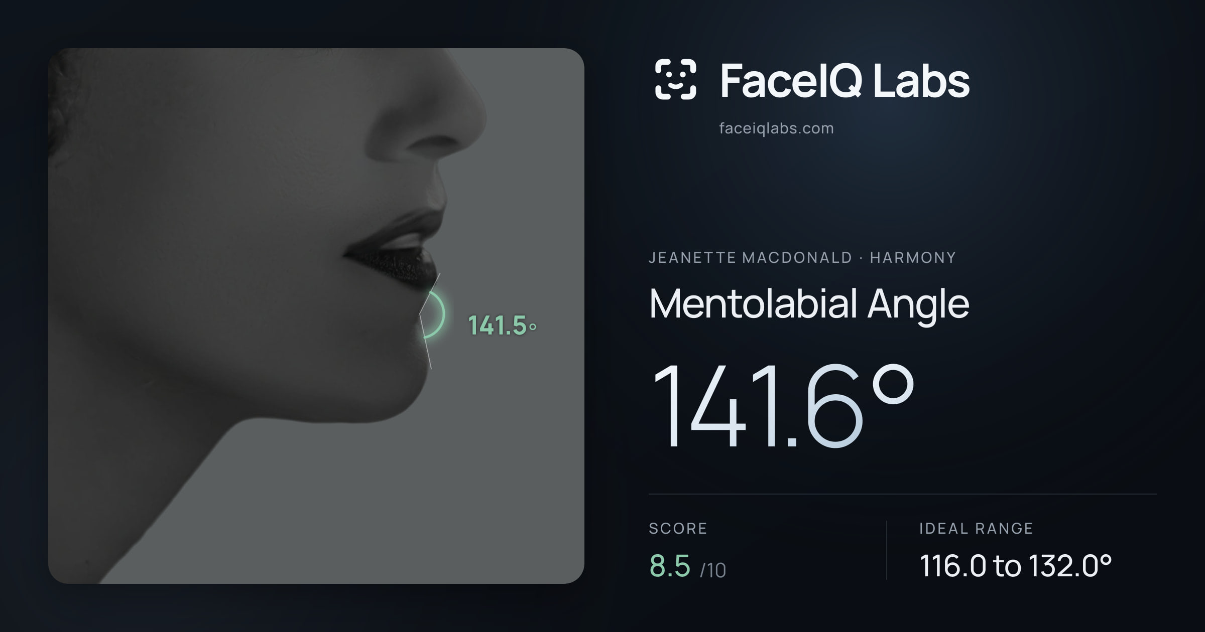 Jeanette MacDonald Mentolabial Angle: 141.6°, drawn on the photo