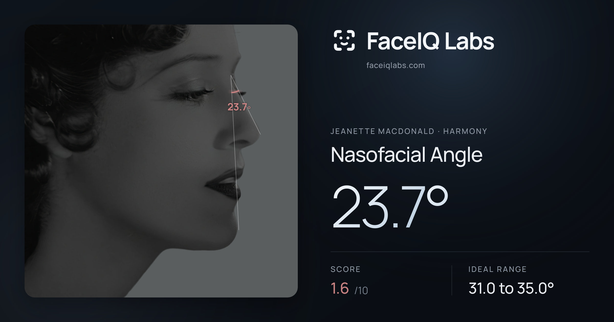 Jeanette MacDonald Nasofacial Angle: 23.7°, drawn on the photo