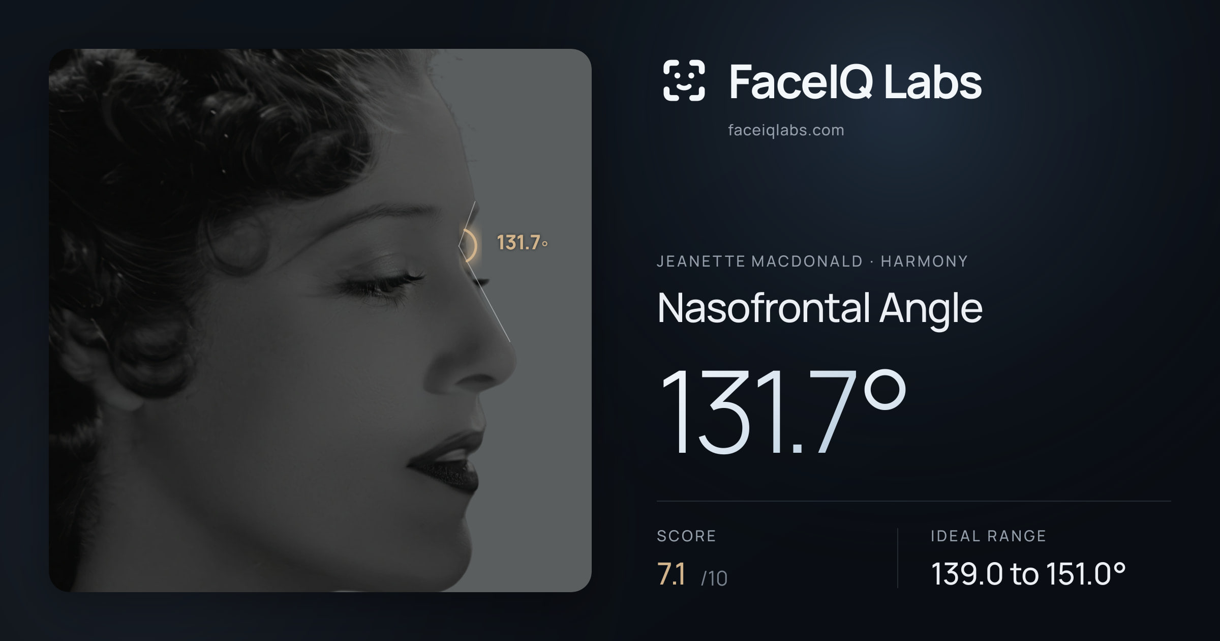 Jeanette MacDonald Nasofrontal Angle: 131.7°, drawn on the photo
