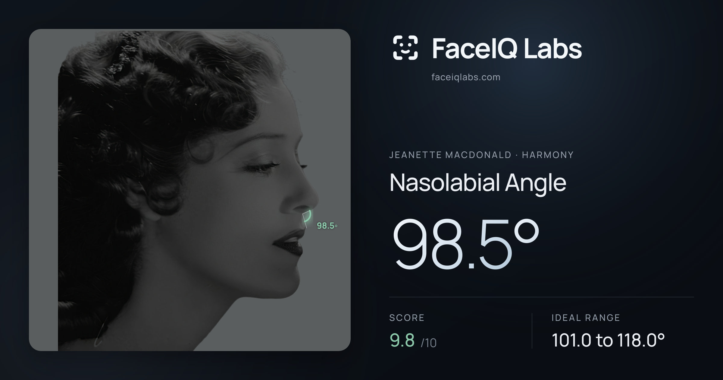 Jeanette MacDonald Nasolabial Angle: 98.5°, drawn on the photo