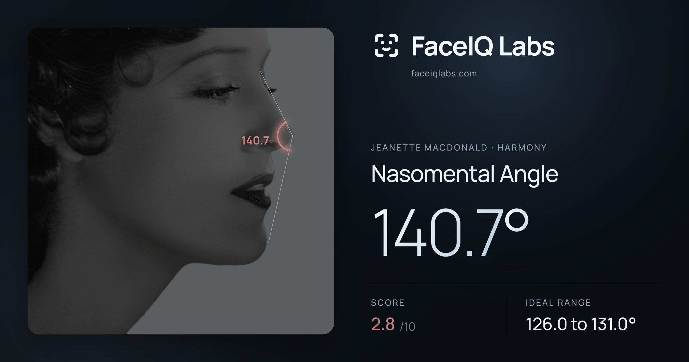 Jeanette MacDonald Nasomental Angle: 140.7°, drawn on the photo