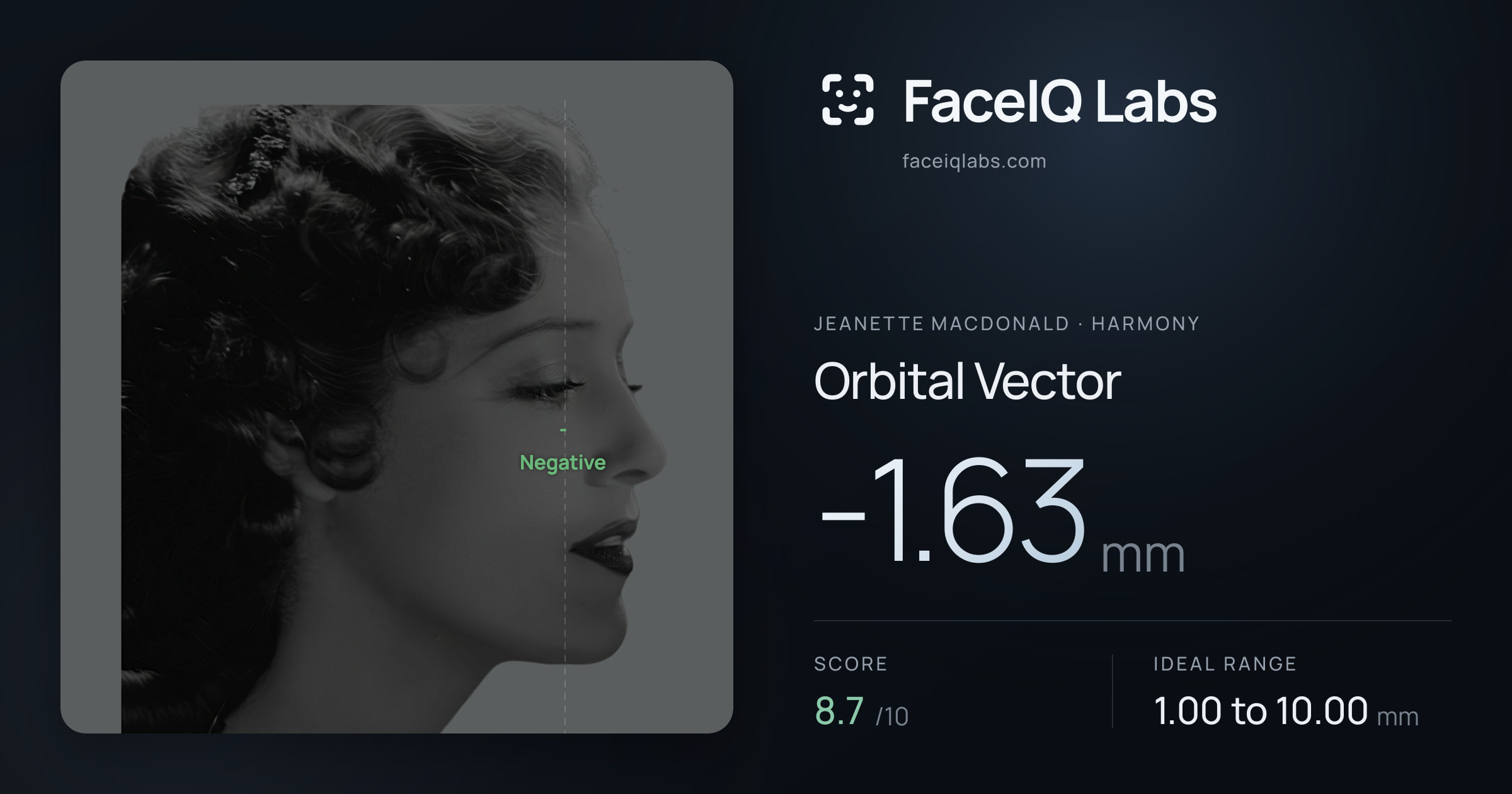Jeanette MacDonald Orbital Vector: -1.63mm, drawn on the photo
