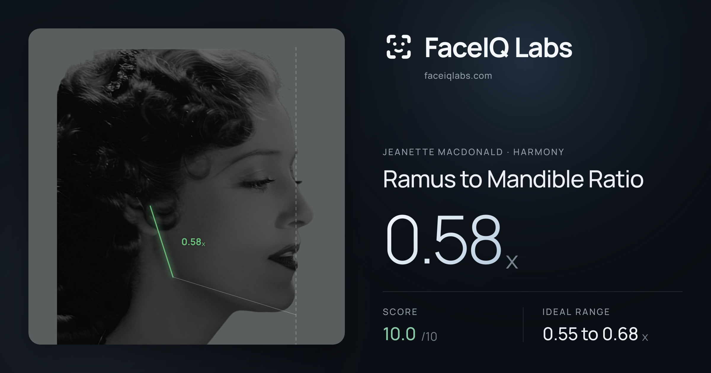 Jeanette MacDonald Ramus to Mandible Ratio: 0.58x, drawn on the photo