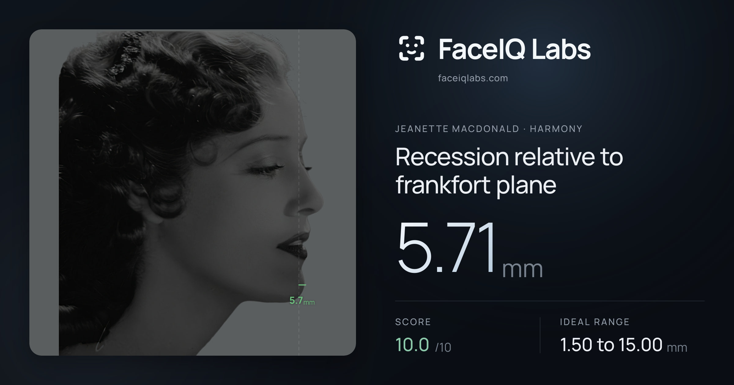 Jeanette MacDonald Recession relative to frankfort plane: 5.71mm, drawn on the photo