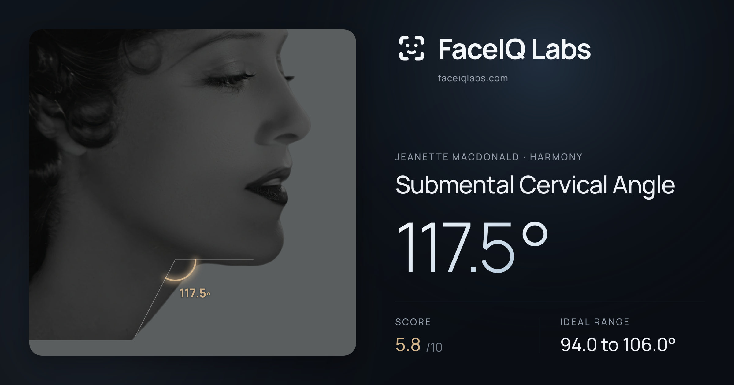 Jeanette MacDonald Submental Cervical Angle: 117.5°, drawn on the photo