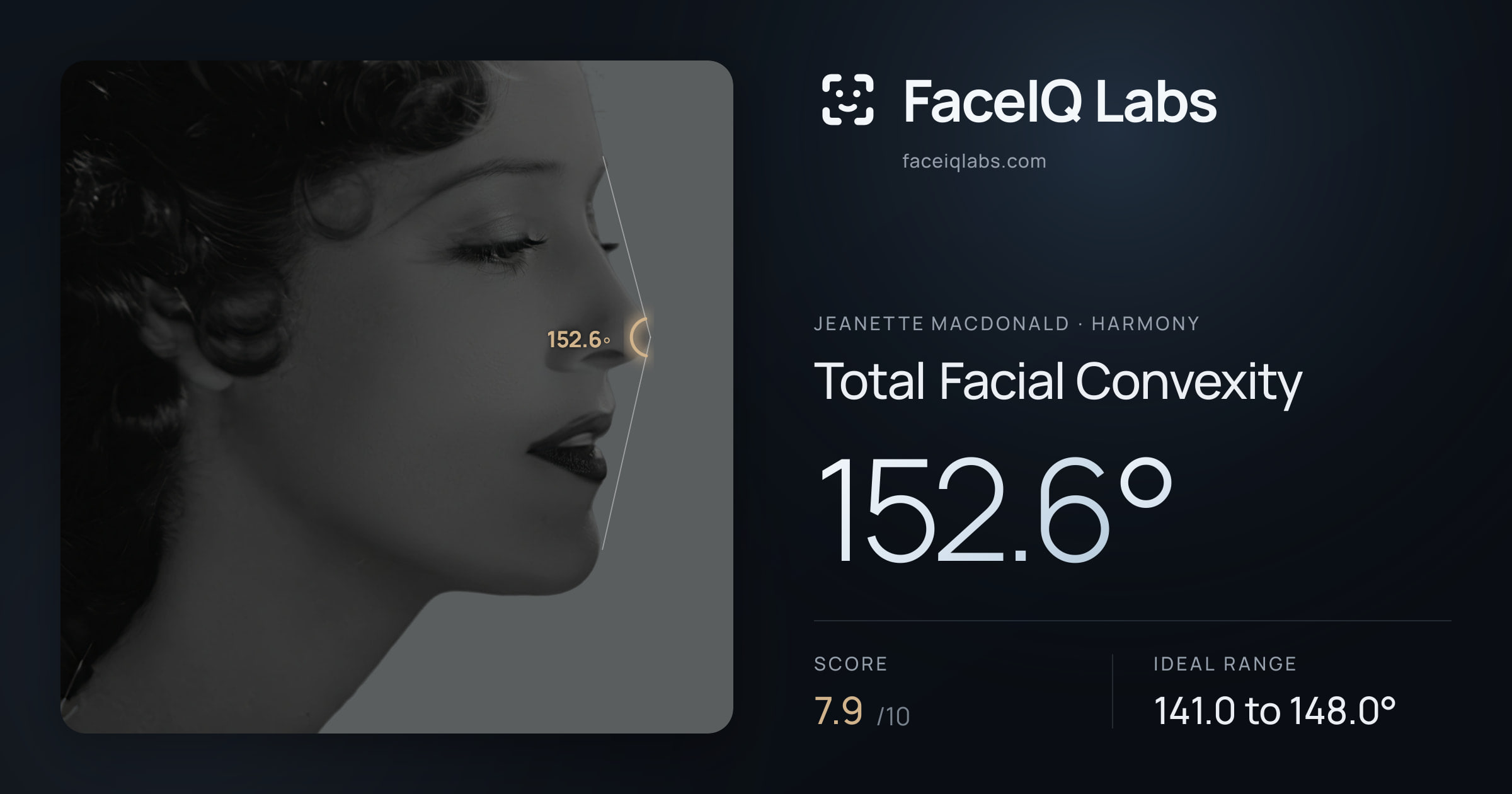 Jeanette MacDonald Total Facial Convexity: 152.6°, drawn on the photo