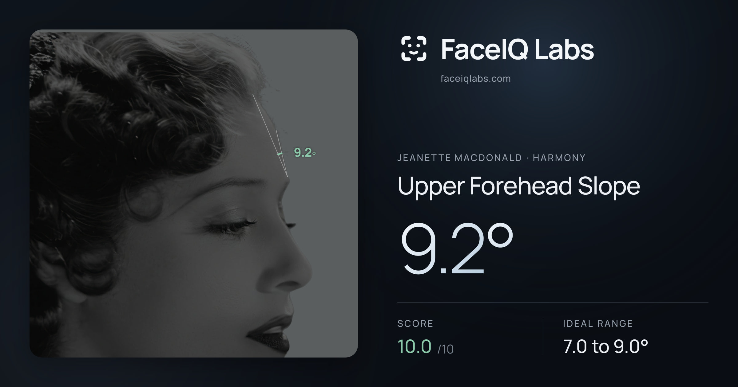 Jeanette MacDonald Upper Forehead Slope: 9.2°, drawn on the photo