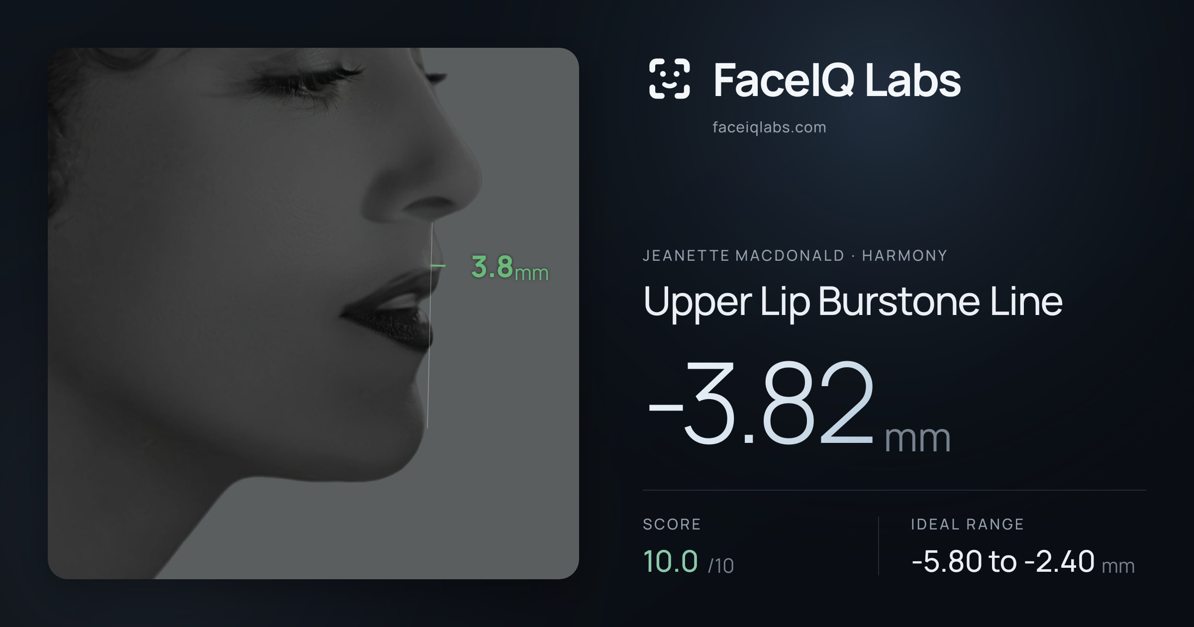 Jeanette MacDonald Upper Lip Burstone Line: -3.82mm, drawn on the photo