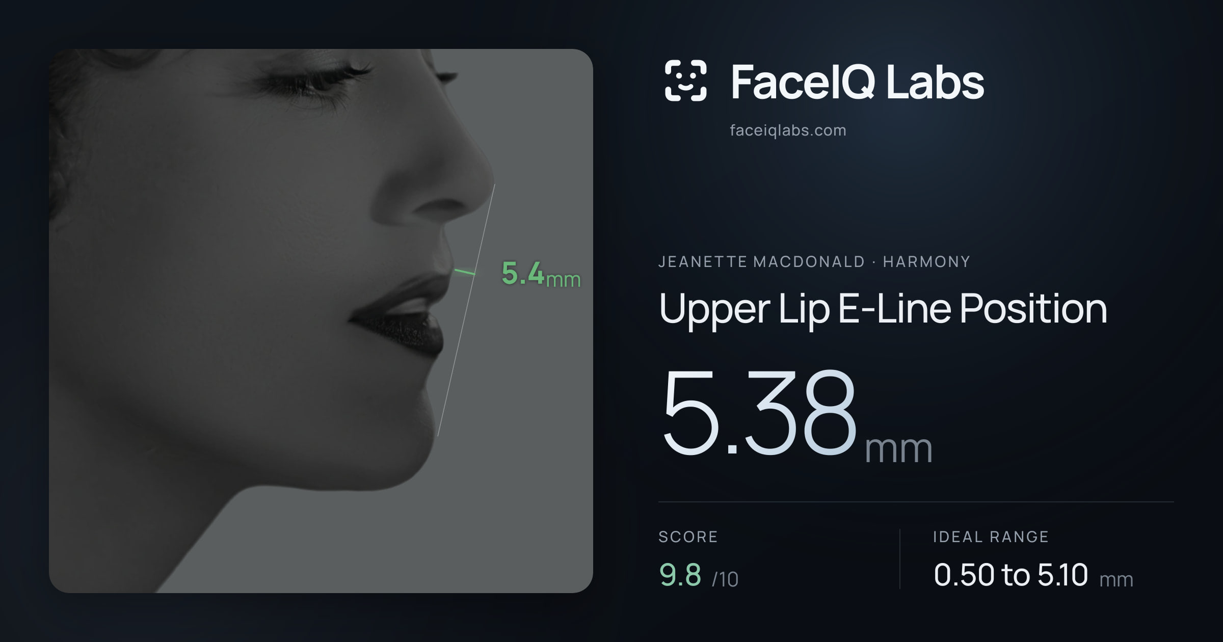 Jeanette MacDonald Upper Lip E-Line Position: 5.38mm, drawn on the photo