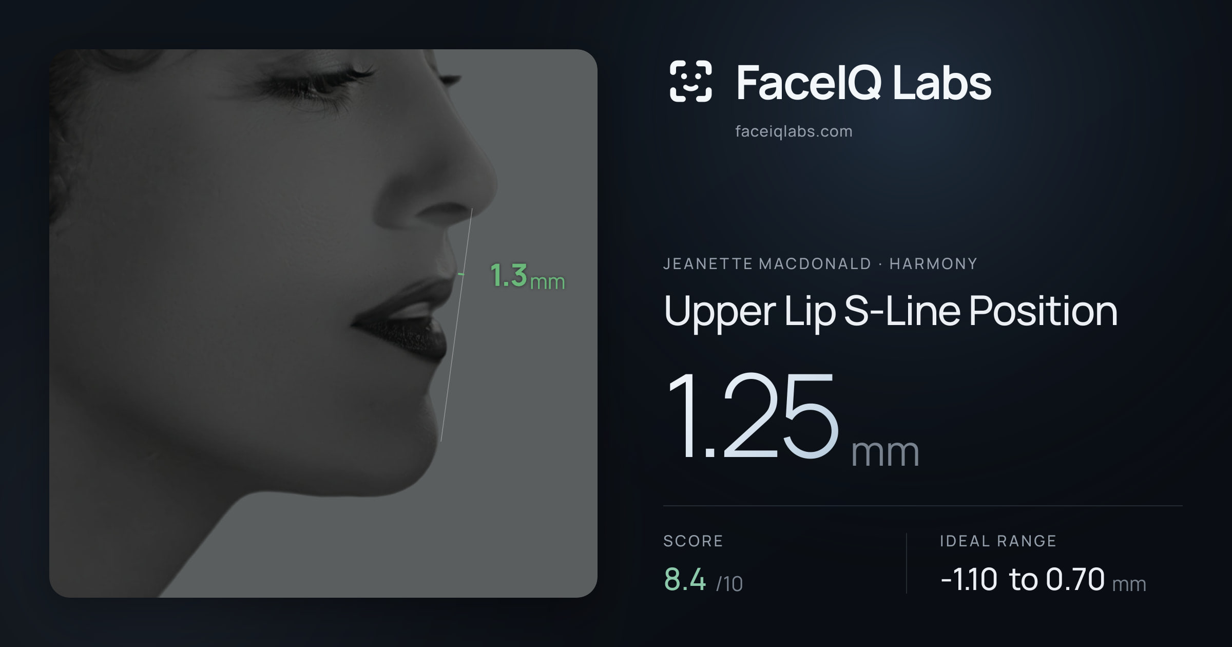 Jeanette MacDonald Upper Lip S-Line Position: 1.25mm, drawn on the photo