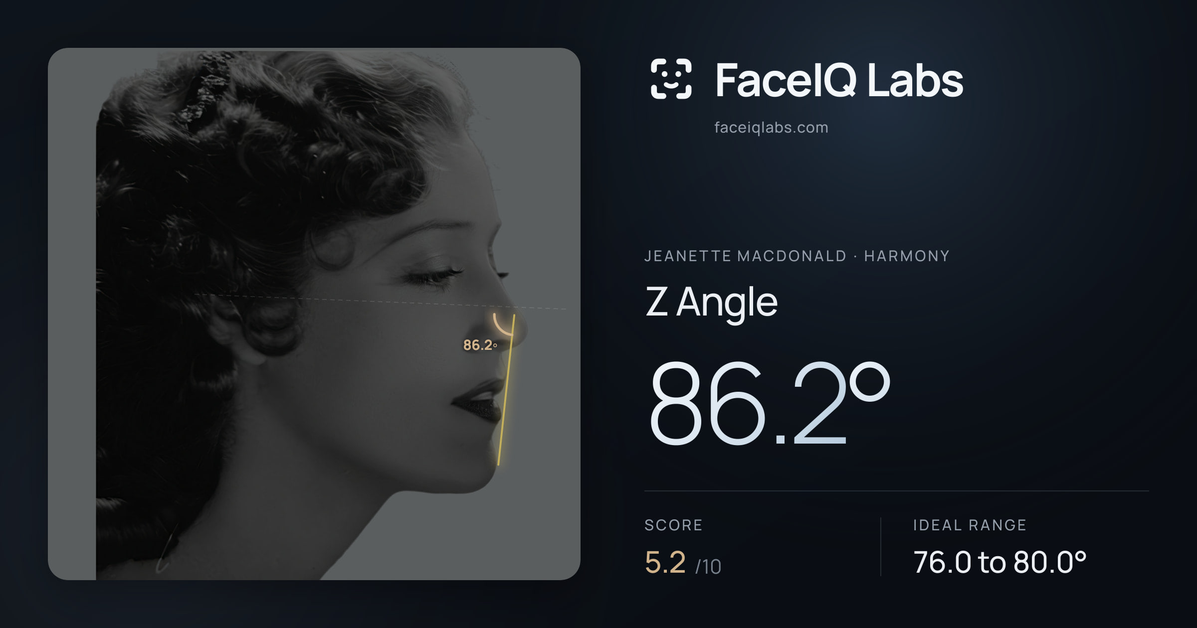 Jeanette MacDonald Z Angle: 86.2°, drawn on the photo