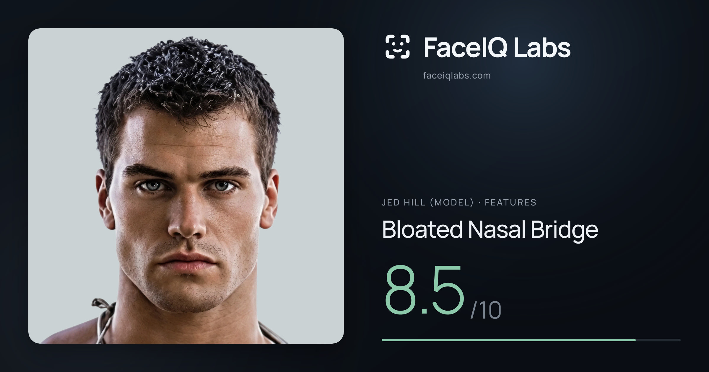 Jed Hill (Model) Bloated Nasal Bridge: 8.5/10, drawn on the photo