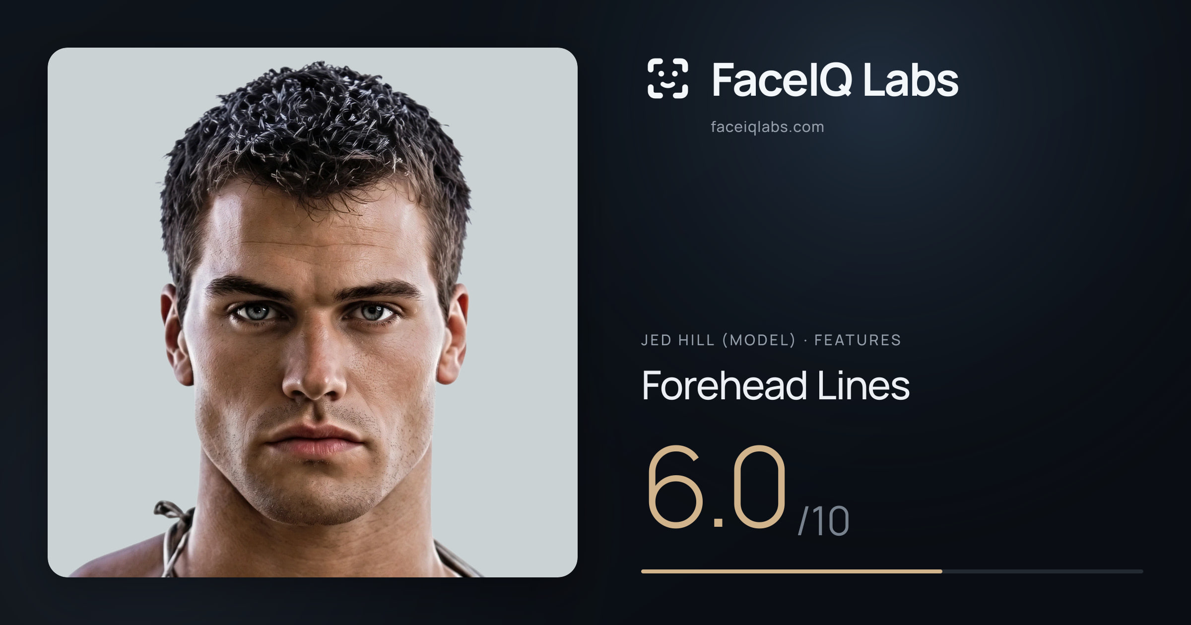 Jed Hill (Model) Forehead Lines: 6.0/10, drawn on the photo