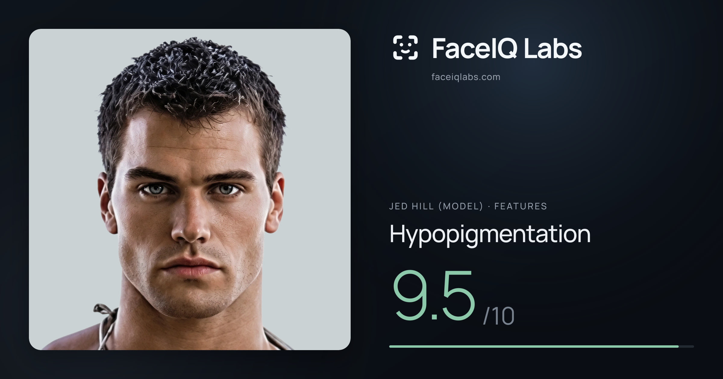 Jed Hill (Model) Hypopigmentation: 9.5/10, drawn on the photo