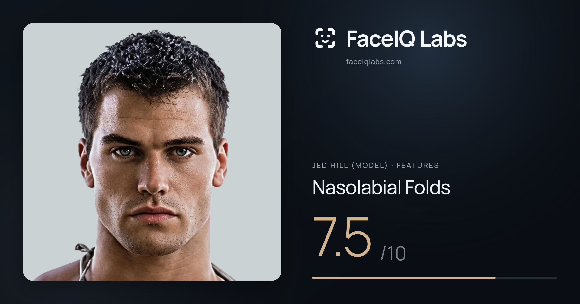 Jed Hill (Model) Nasolabial Folds: 7.5/10, drawn on the photo