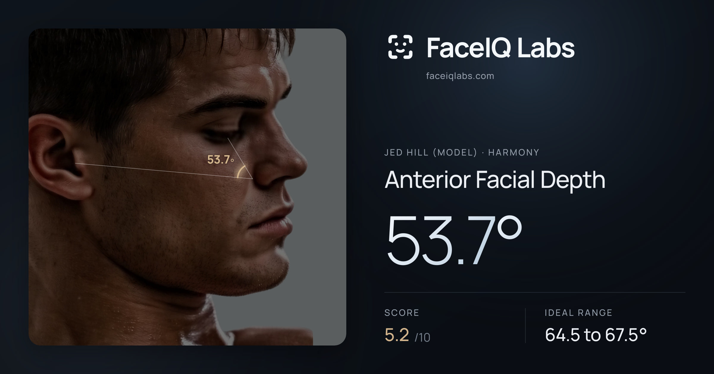 Jed Hill (Model) Anterior Facial Depth: 53.7°, drawn on the photo