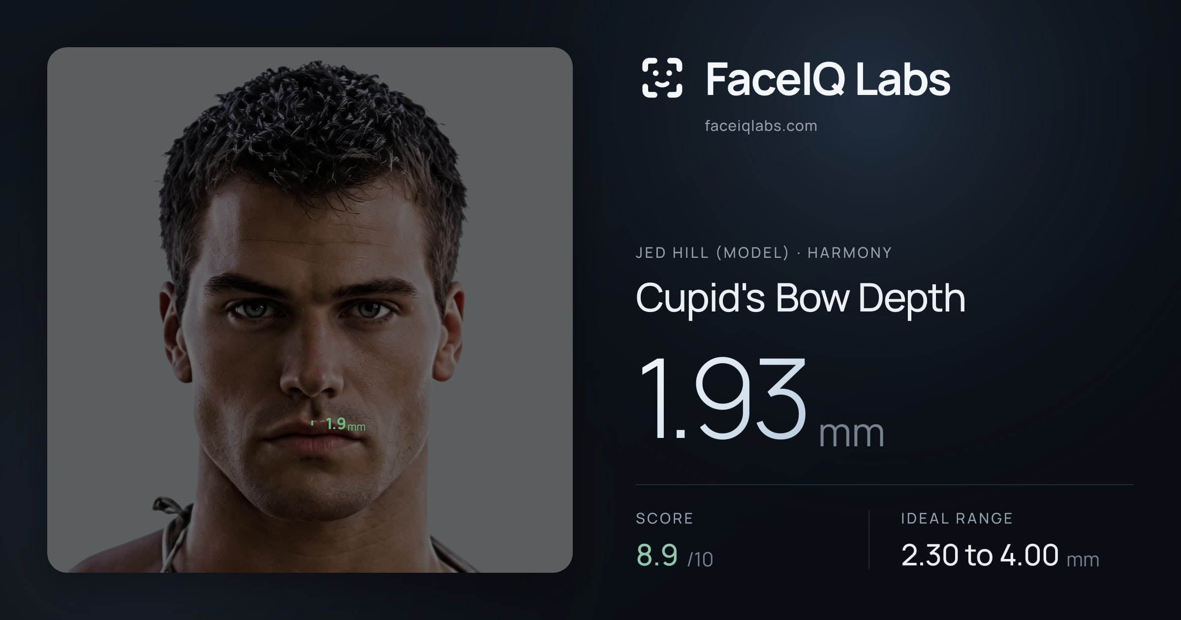 Jed Hill (Model) Cupid's Bow Depth: 1.93mm, drawn on the photo
