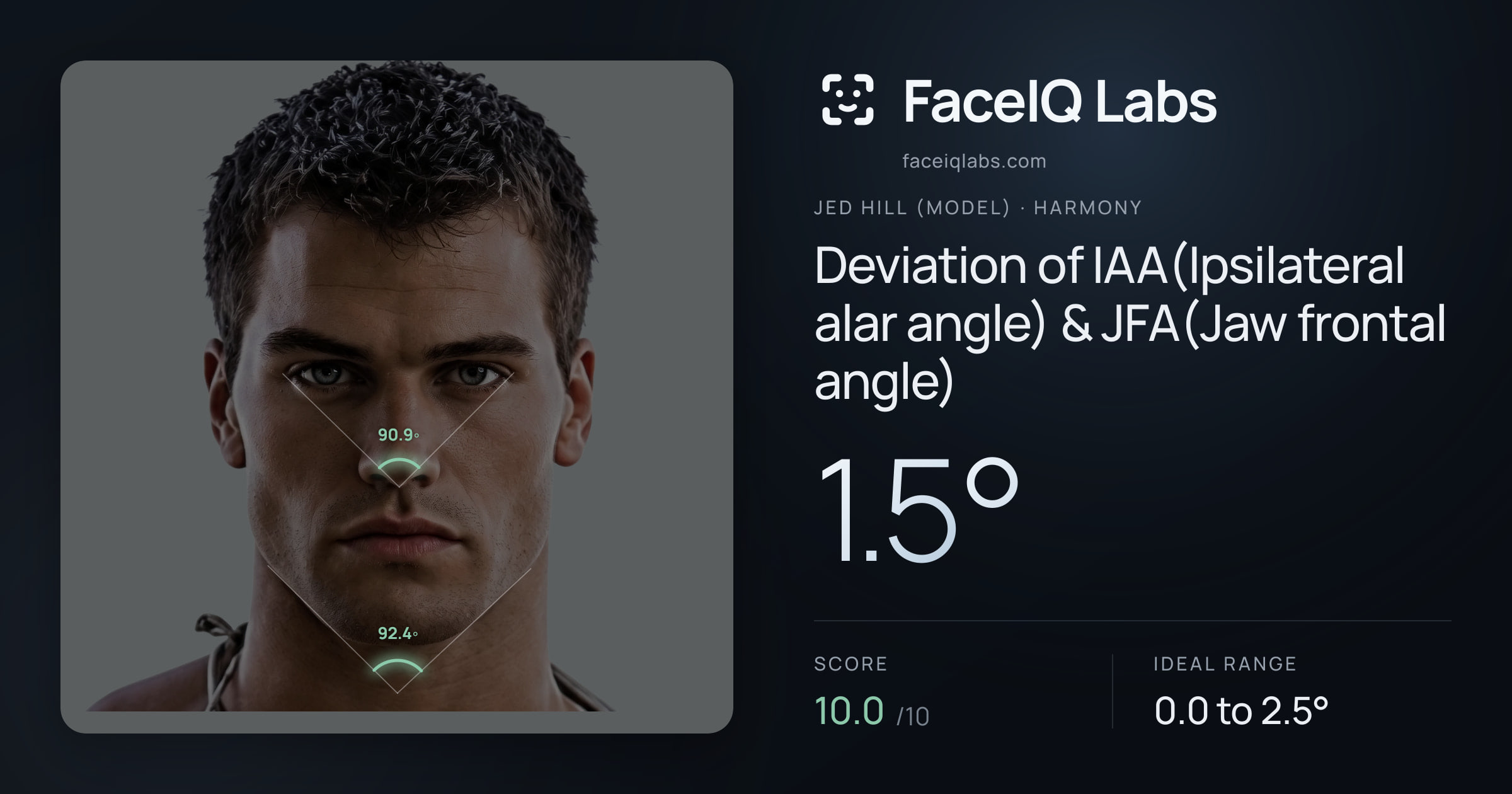 Jed Hill (Model) Deviation of IAA(Ipsilateral alar angle) & JFA(Jaw frontal angle): 1.5°, drawn on the photo