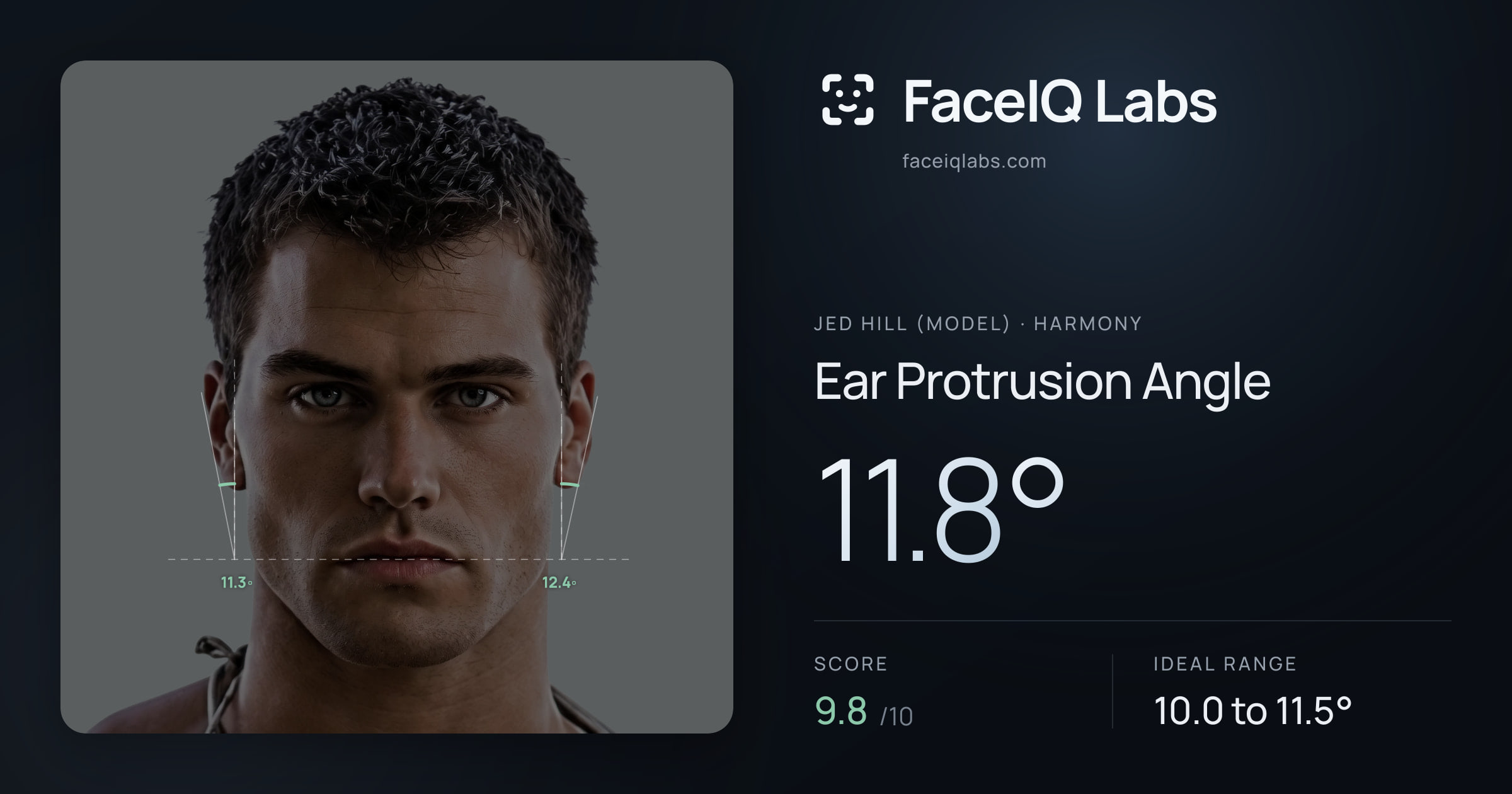 Jed Hill (Model) Ear Protrusion Angle: 11.8°, drawn on the photo