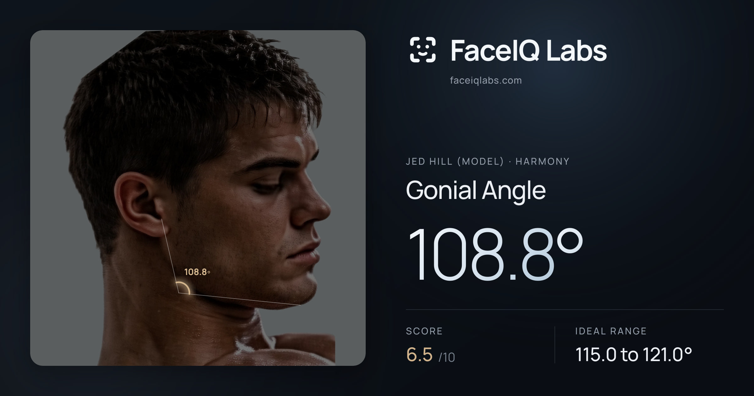 Jed Hill (Model) Gonial Angle: 108.8°, drawn on the photo