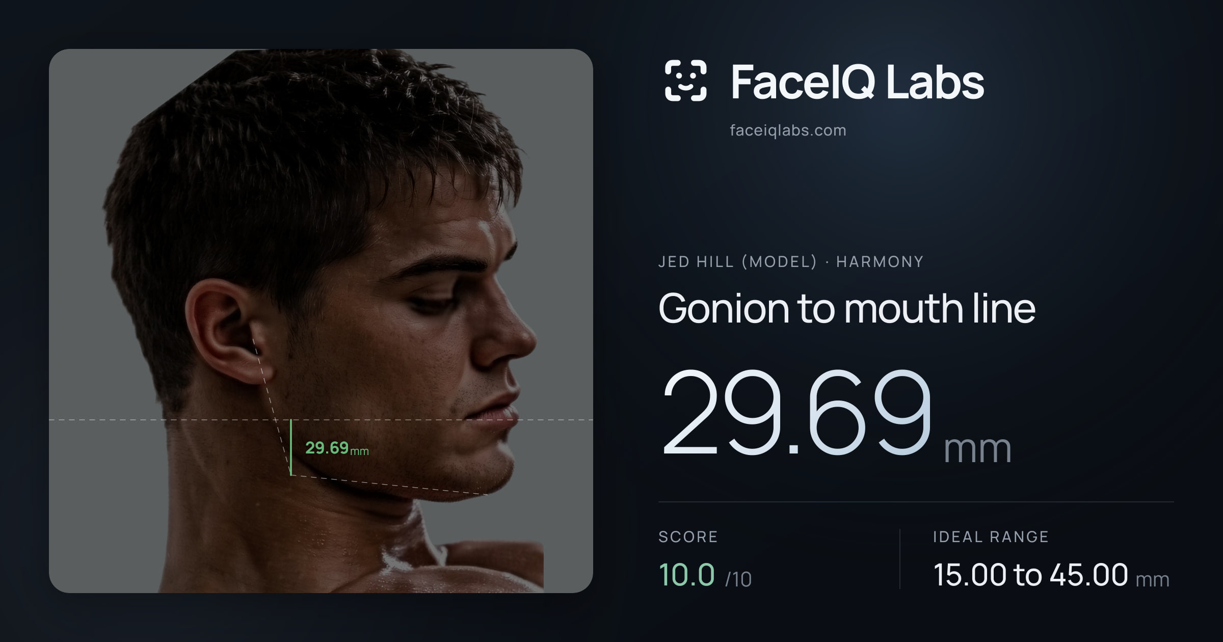 Jed Hill (Model) Gonion to mouth line: 29.69mm, drawn on the photo