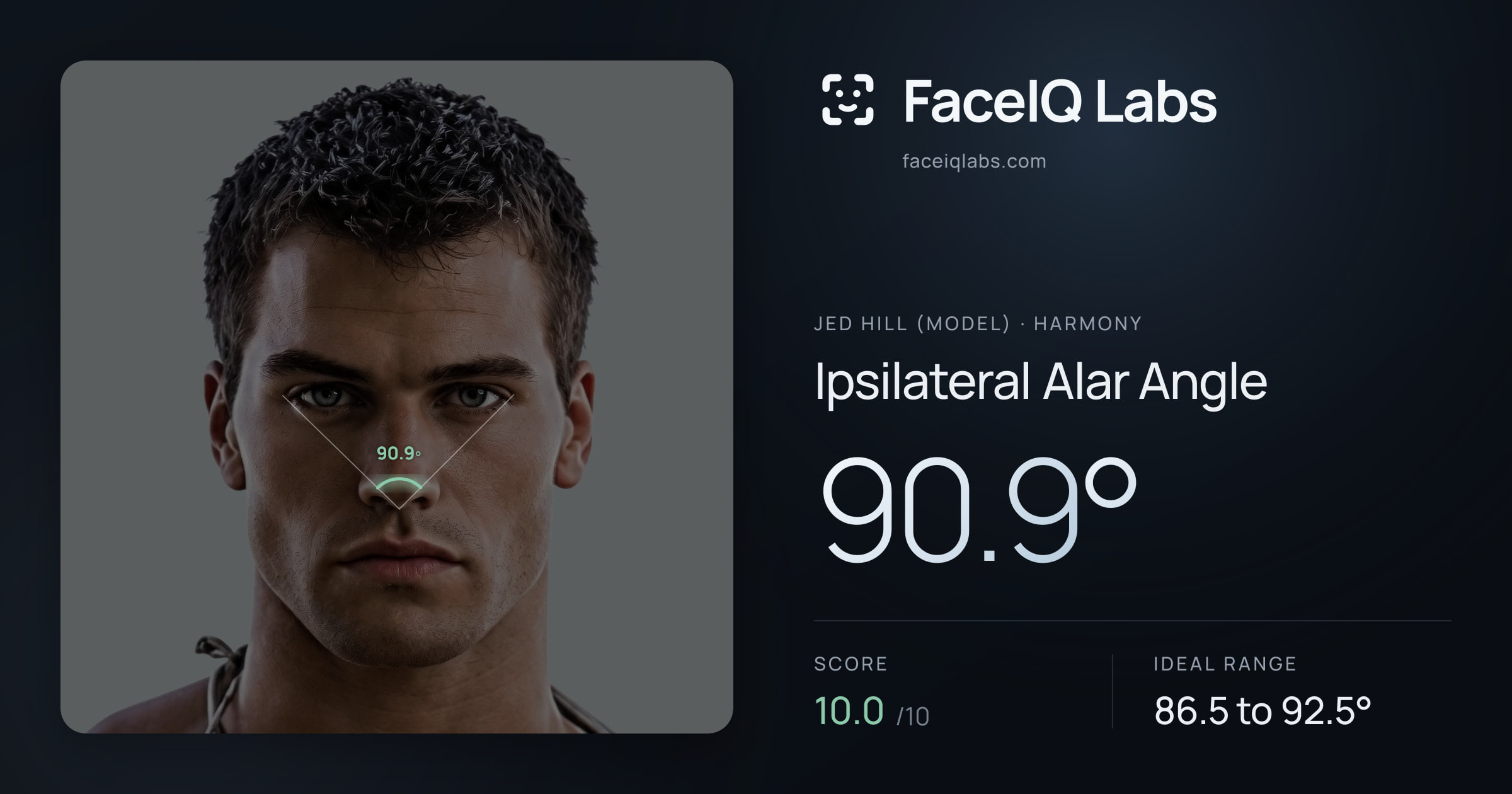 Jed Hill (Model) Ipsilateral Alar Angle: 90.9°, drawn on the photo