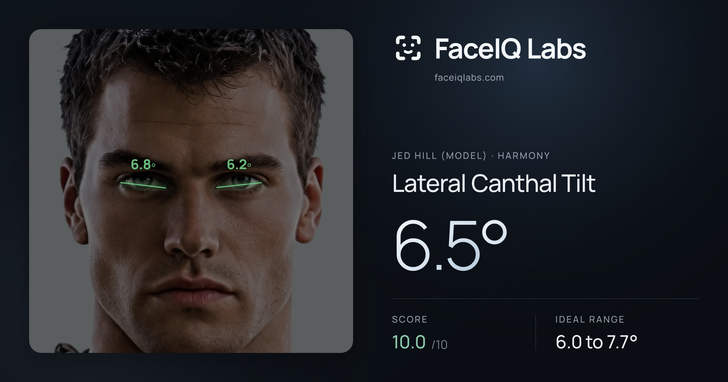 Jed Hill (Model) Lateral Canthal Tilt: 6.5°, drawn on the photo