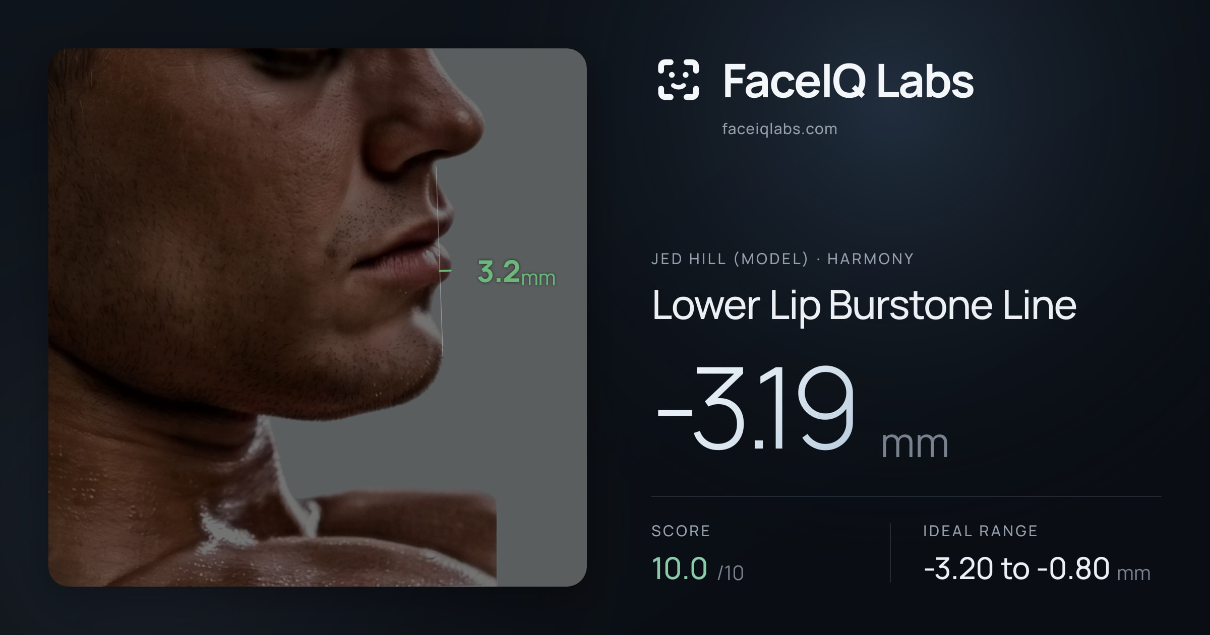 Jed Hill (Model) Lower Lip Burstone Line: -3.19mm, drawn on the photo