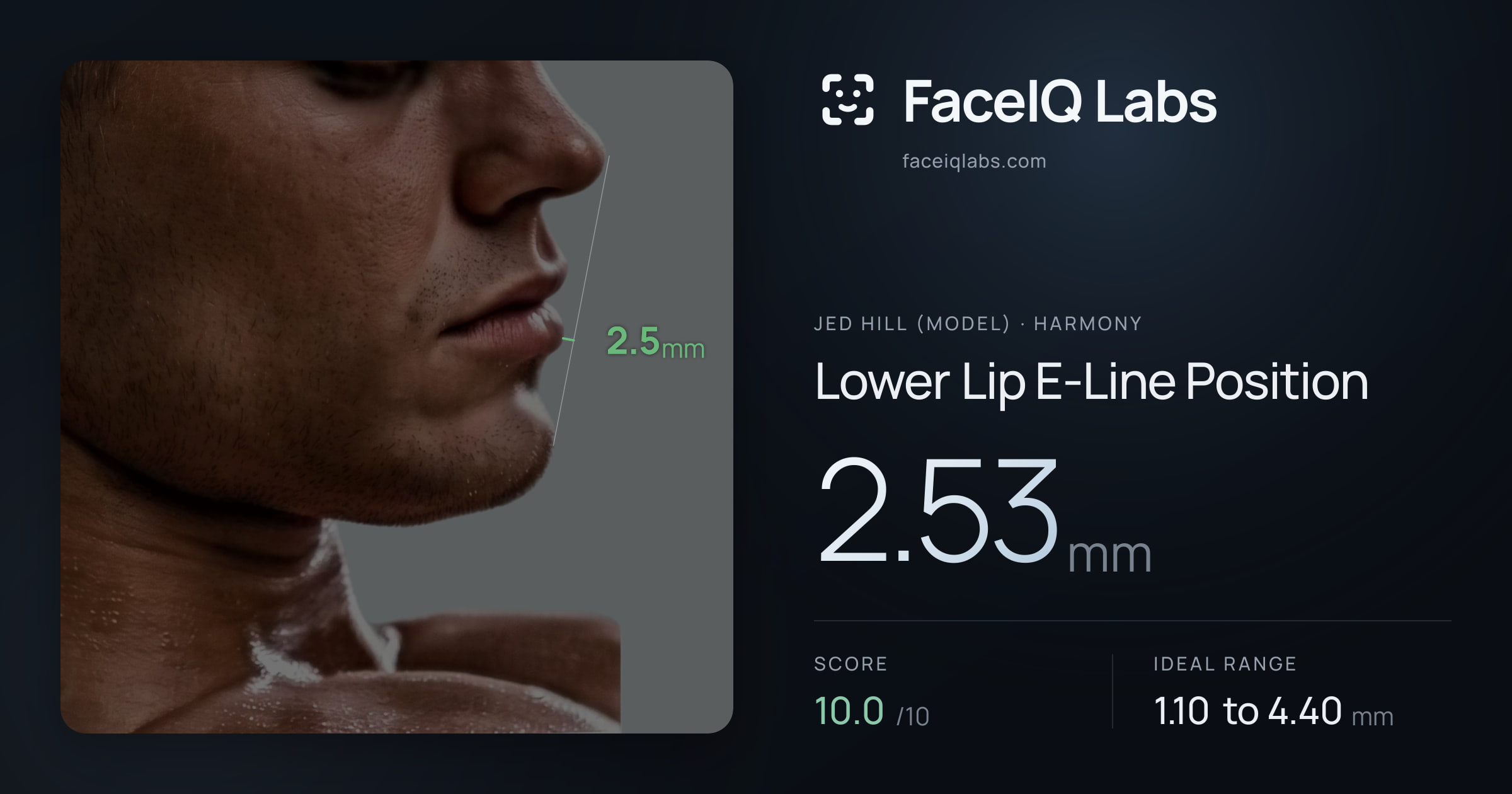 Jed Hill (Model) Lower Lip E-Line Position: 2.53mm, drawn on the photo