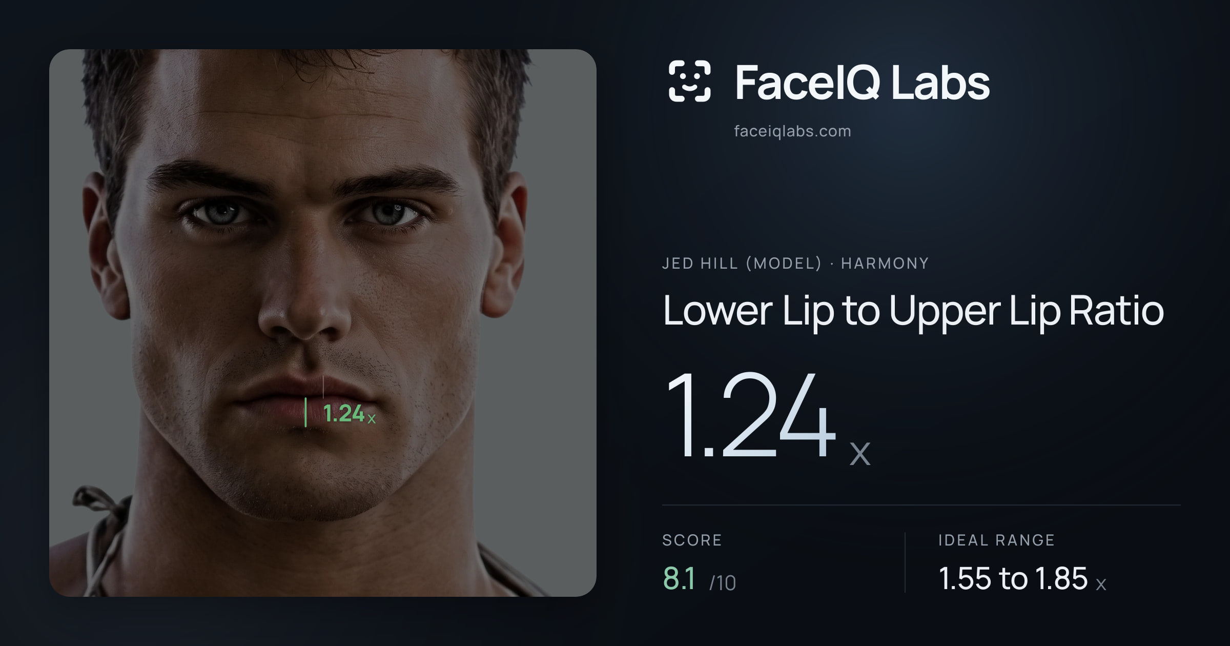 Jed Hill (Model) Lower Lip to Upper Lip Ratio: 1.24x, drawn on the photo