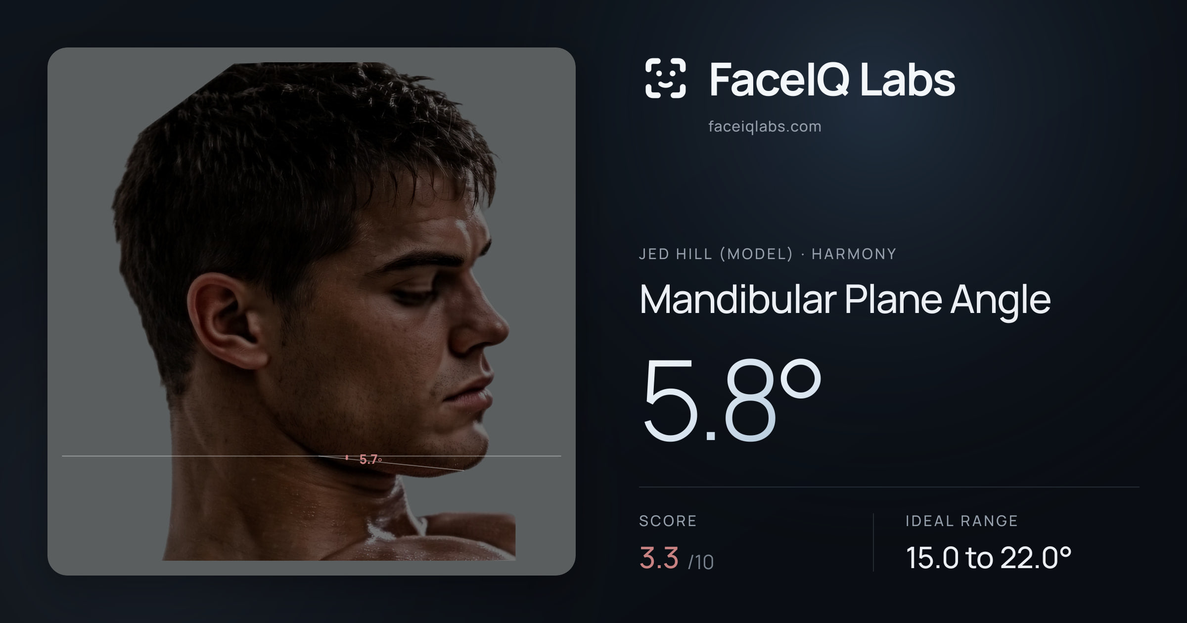 Jed Hill (Model) Mandibular Plane Angle: 5.8°, drawn on the photo