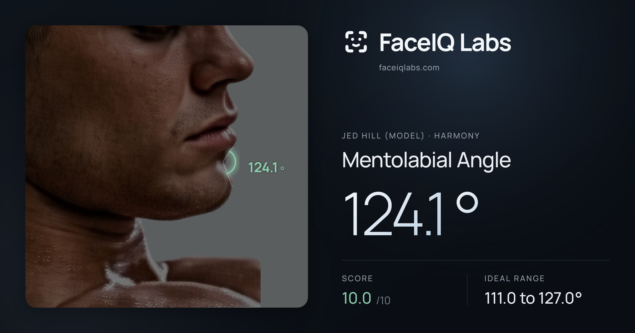 Jed Hill (Model) Mentolabial Angle: 124.1°, drawn on the photo