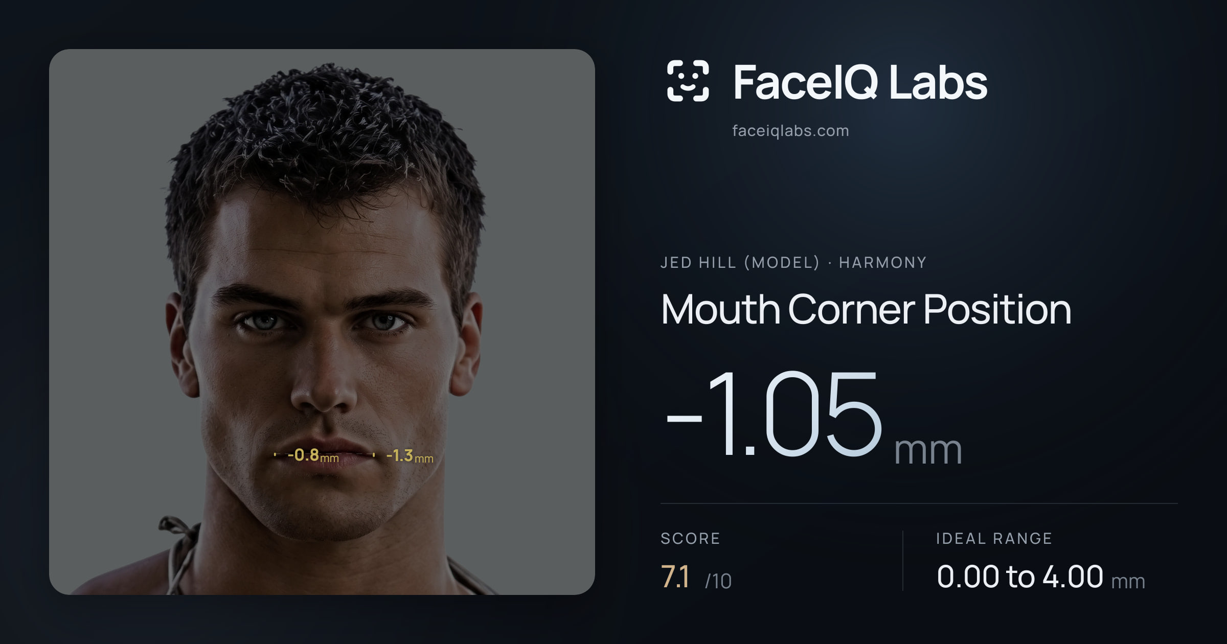 Jed Hill (Model) Mouth Corner Position: -1.05mm, drawn on the photo