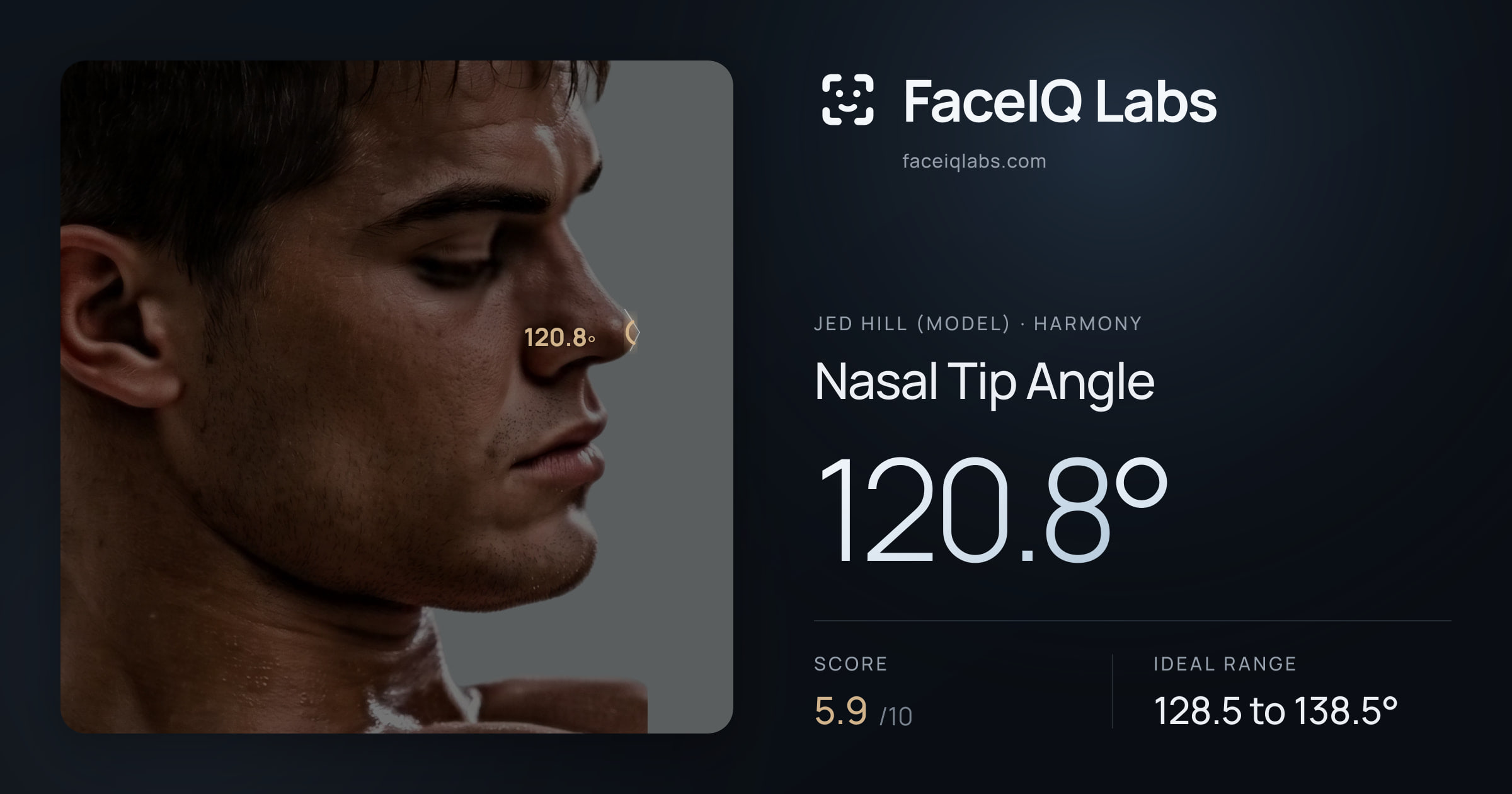 Jed Hill (Model) Nasal Tip Angle: 120.8°, drawn on the photo