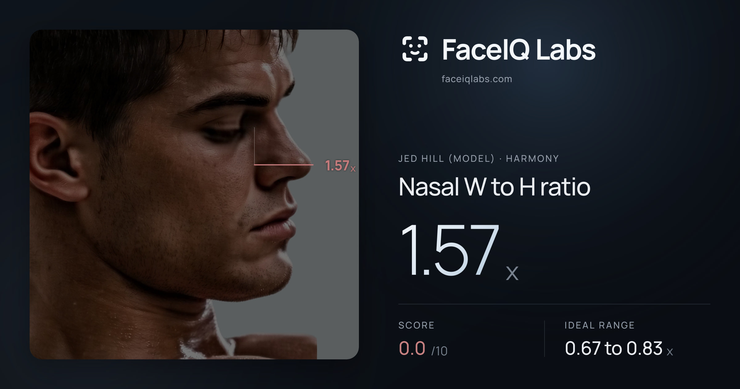 Jed Hill (Model) Nasal W to H ratio: 1.57x, drawn on the photo