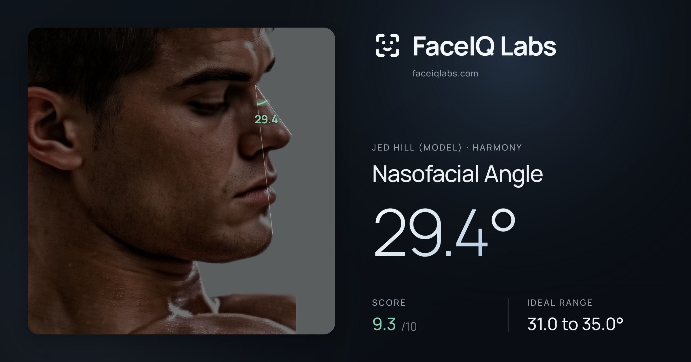 Jed Hill (Model) Nasofacial Angle: 29.4°, drawn on the photo