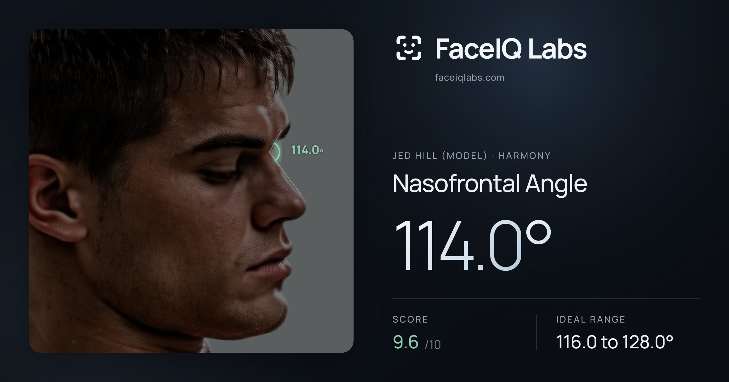 Jed Hill (Model) Nasofrontal Angle: 114.0°, drawn on the photo
