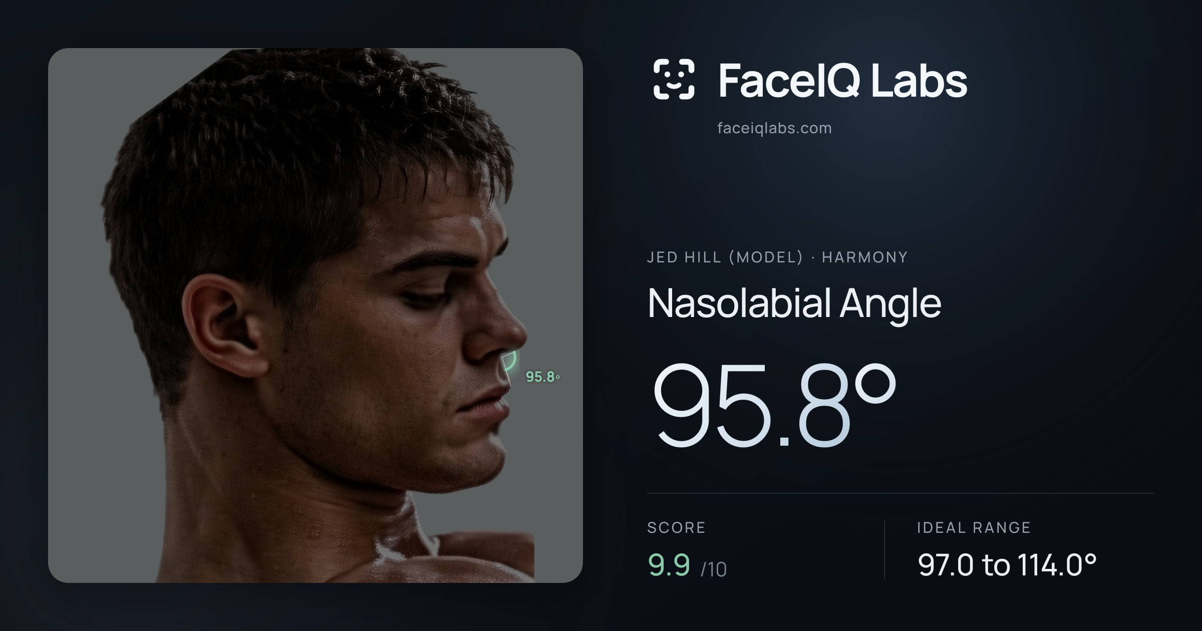 Jed Hill (Model) Nasolabial Angle: 95.8°, drawn on the photo