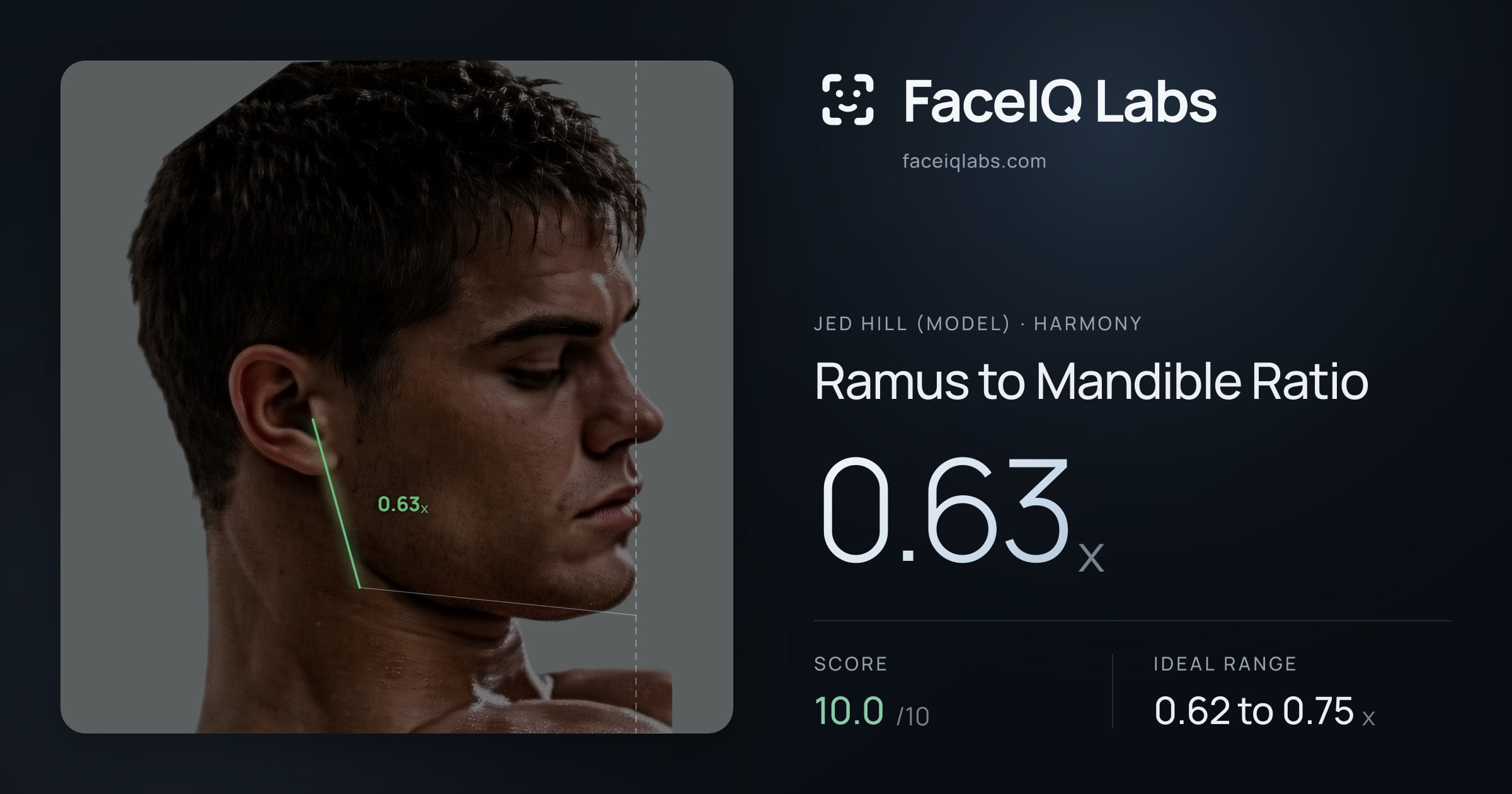 Jed Hill (Model) Ramus to Mandible Ratio: 0.63x, drawn on the photo